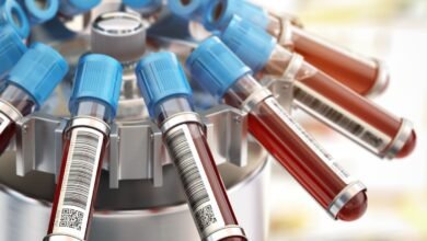 Cientistas da USP criam técnica para detectar câncer em sangue e urina