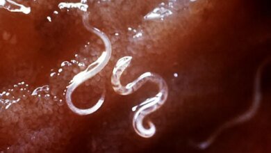 Infecção por vermes parasitas pode ser futuro tratamento para colite ulcerativa