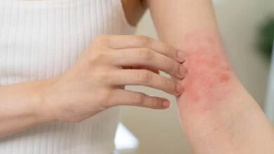 Esporotricose: Saiba o que é e como prevenir doença de pele provocada por fungo 