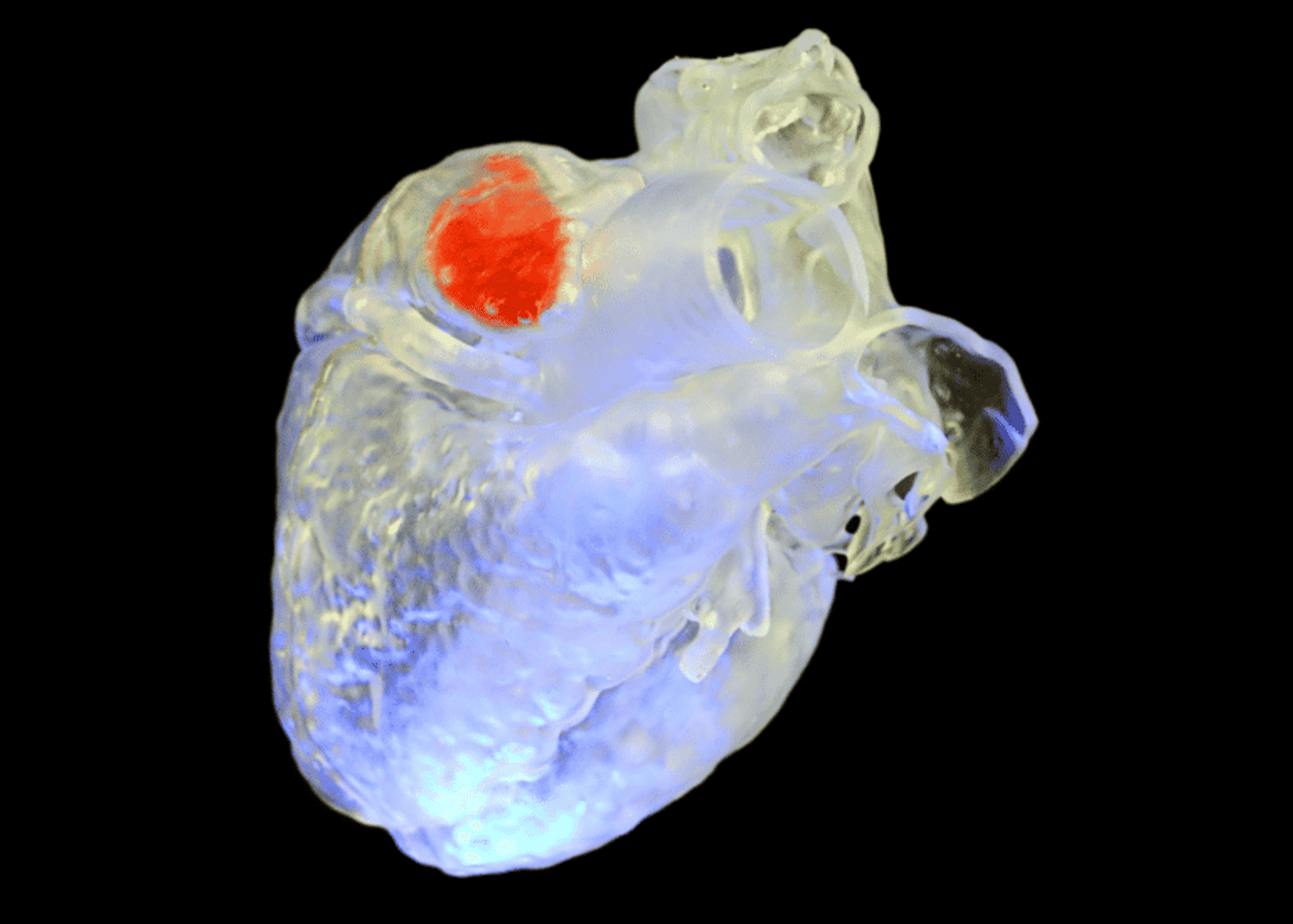 Nova técnica facilita impressões 3D de órgãos humanos