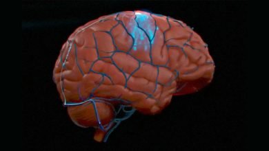 Ilustração de implante cerebral da Synchron